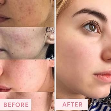 Enzyme Dead cell removal Scrub - Exfoliant | Clean Pores | Brightening | Skin Polishing | Texture Refining